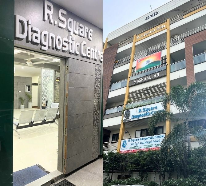 R Square Diagnostics