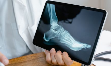 Digital X-Ray